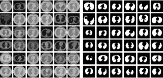 Results figure: lung CT slices shown alongside their predicted segmentation masks